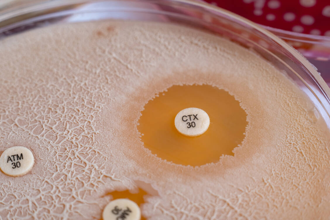 Antibiotikaresistenzen stellen zunehmend eine Gefahr dar. / © Adobe Stock/Mohammed