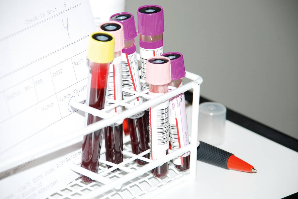 Beim Off-Label-Einsatz von Medikamenten gegen das neue Coronavirus sollten bestimmte Laborparameter überwacht werden – welche genau, hat die AMK zusammengefasst. / Foto: Fotolia/littlebell