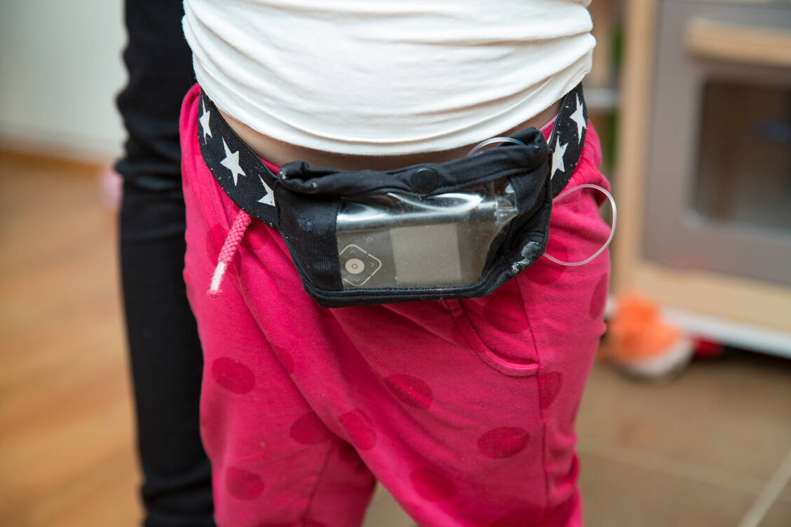 Viele Vorschulkinder mit Typ-1-Diabetes sind bereits mit einer Insulinpumpe versorgt. Ein Hybrid-Closed-Loop-System könnte noch zusätzliche Vorteile bringen.  / Foto: Adobe Stock/ Suzi Media
