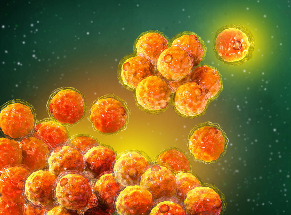 Die heterozygote familiäre Hypercholesterolämie ist eine angeborene Fettstoffwechselstörung. Betroffene haben meist bereits im Kindesalter erhöhte LDL-Cholesterol-Spiegel. / Foto: Adobe Stock/sokolova_sv