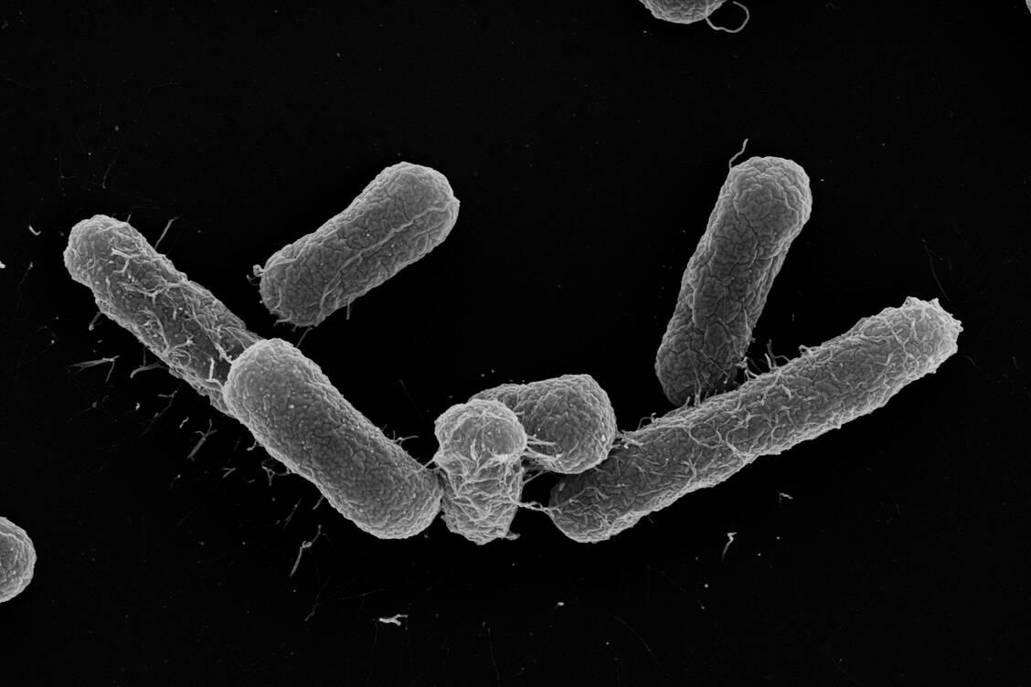 Elektronenmikroskopische Aufnahme des Escherichia-coli-Stamms, der multiresistente E.-coli-Stämme verdrängen kann. / © HZI/Mathias Müsken
