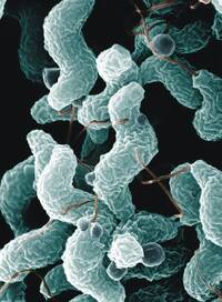Unterschiedliche Erreger des Darm-Dilemmas unter dem Rasterelektronenmikroskop: Campylobakter mit typischer Spiralform (oben), E.-coli-Keime sind oval und formatieren sich in Gruppen (Mitte), Salmonellen bilden zahlreiche Geißeln aus (unten).
<p class="fotonachweis">Fotos: Agricultural Research Service (oben, Mitte), United Department of Health and Human Services (unten)</p>