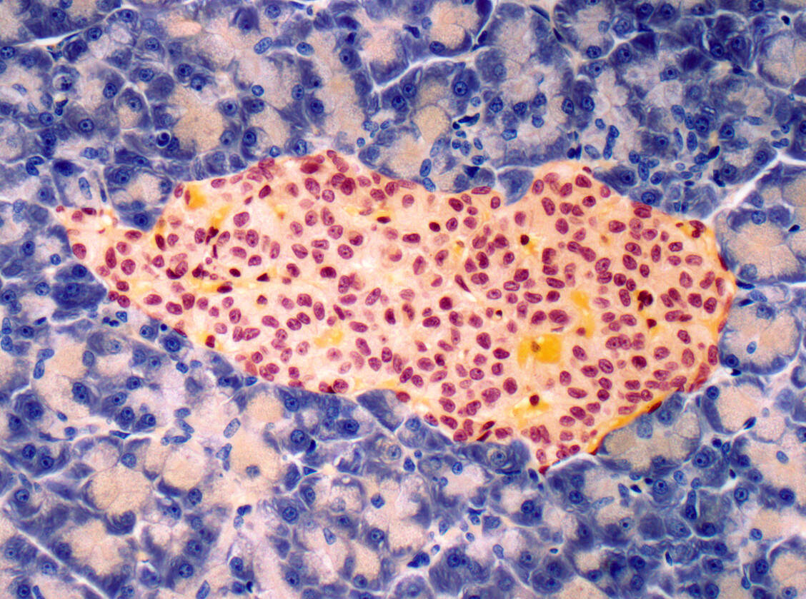 Die Langerhans-Inseln (rot und gelb gefärbte Zellen) sind die Hormonproduzenten der Bauchspeicheldrüse. / Foto: Getty Images/Steve Gschmeissner