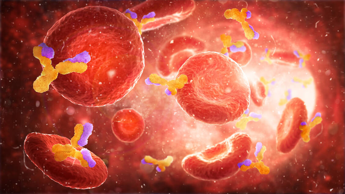 Bei einer Autoimmunerkrankung erkennt das Immunsystem körpereigne Strukturen irrtümlich als fremd. Im Blut lassen sich dann Autoantikörper sowie eine vermehrte Aktivität des Immunsystems nachweisen.  / Foto: Getty Images/urfinguss