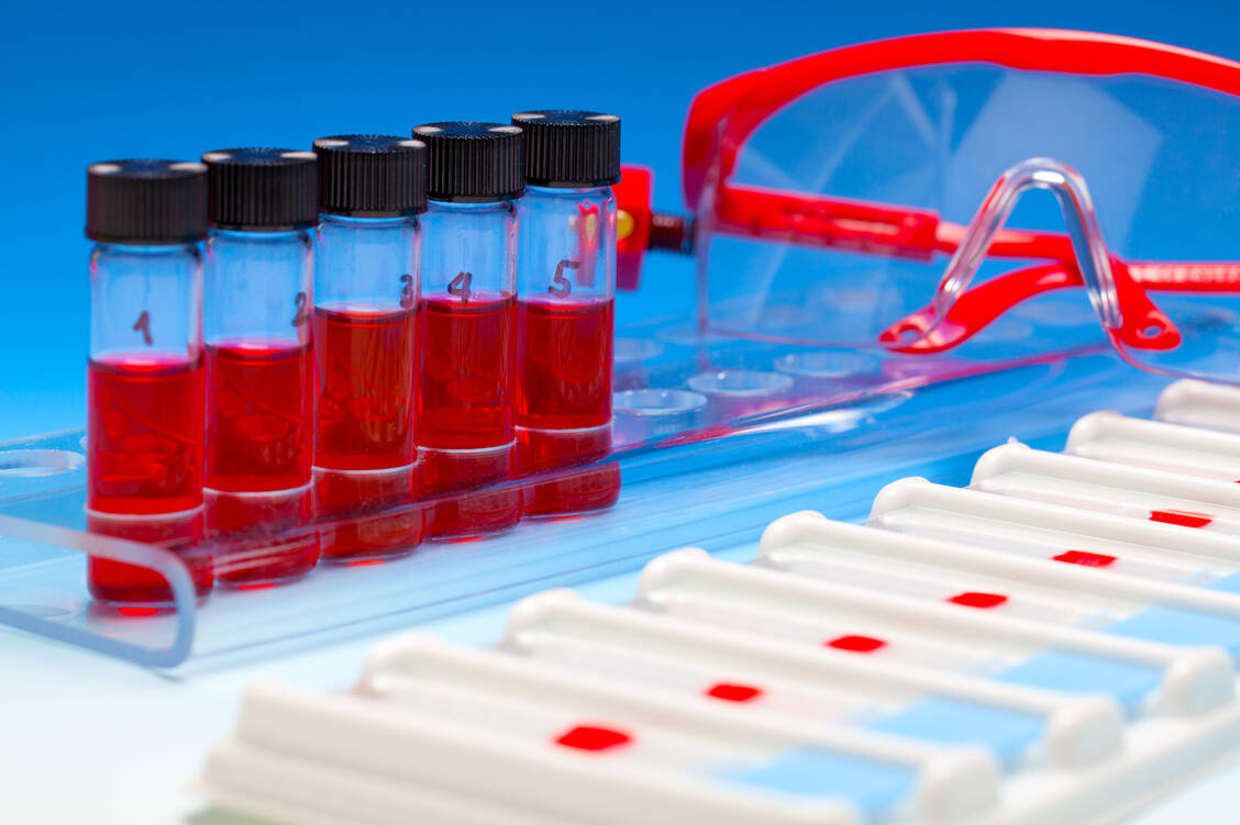 Die Liquid Biopsy könnte die Verlaufskontrolle von Tumorerkrankungen deutlich vereinfachen. / Foto: Adobe Stock/motorolka