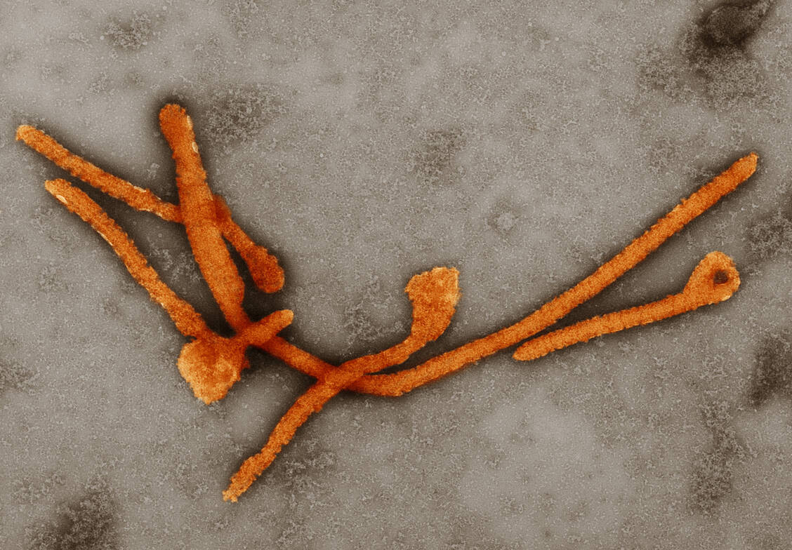 Das Ebola-Virus gehört zur Familie der Filoviridae. Infektionen lösen ein hämorrhagisches Fieber aus und haben eine hohe Sterblichkeitsrate. / Foto: RKI/Hans Gelderblom