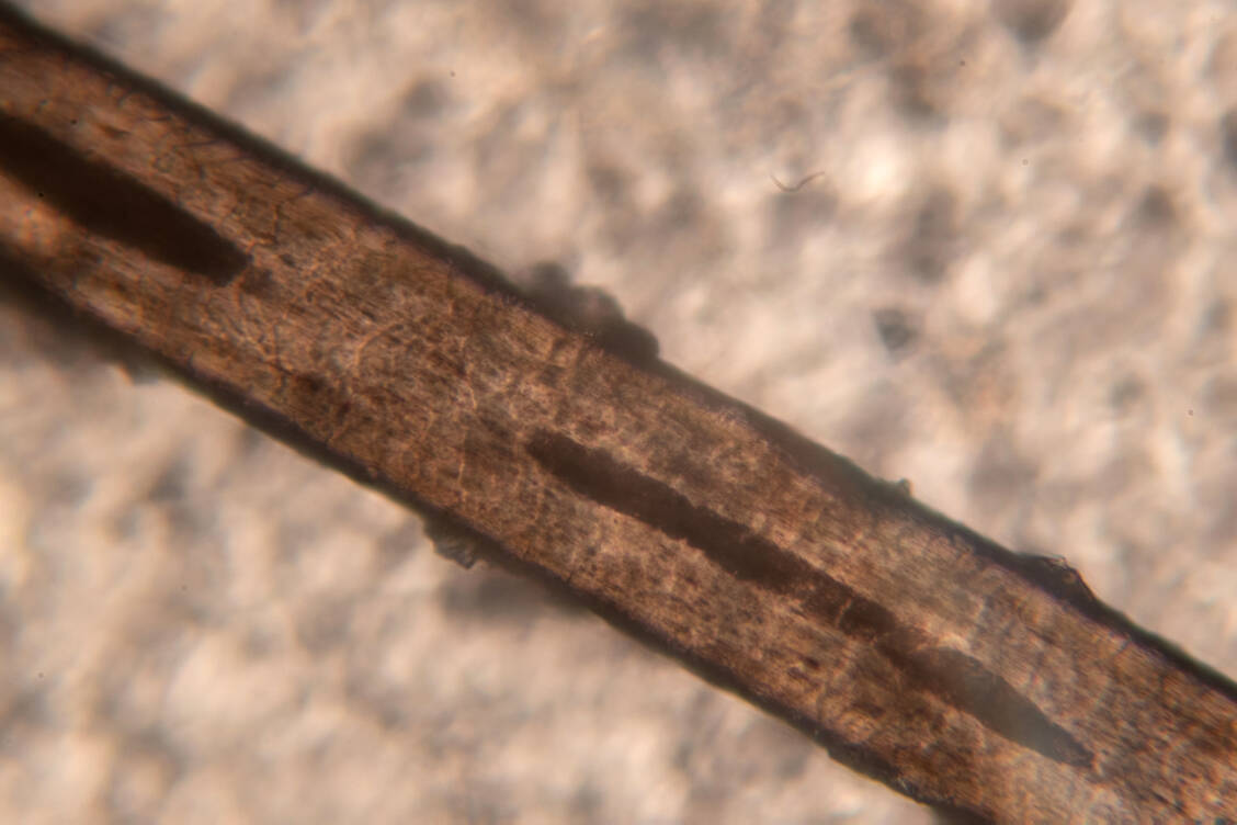 Bequeme Transportbahn: Entlang des menschlichen Haares können Mikropartikel von der Hautoberfläche bis zum Haarfollikel wandern. / © Shutterstock/Mohammed_Al_Ali