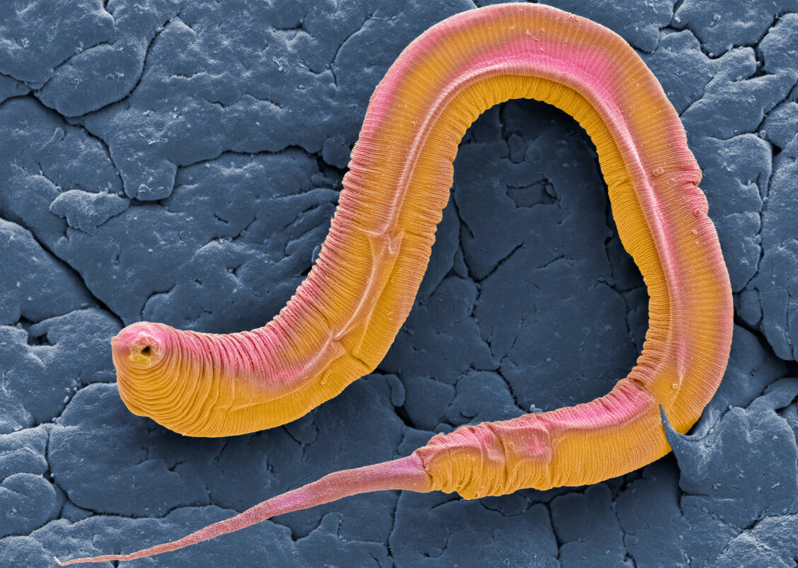 Den Fadenwurm Caenorhabditis elegans nutzten die Forscher als Modellorganismus, um die Wirkung des veränderten Mikrobioms auf das Verhalten zu untersuchen. / Foto: Getty Images/Steven Gschmeissner/Science Photo Library
