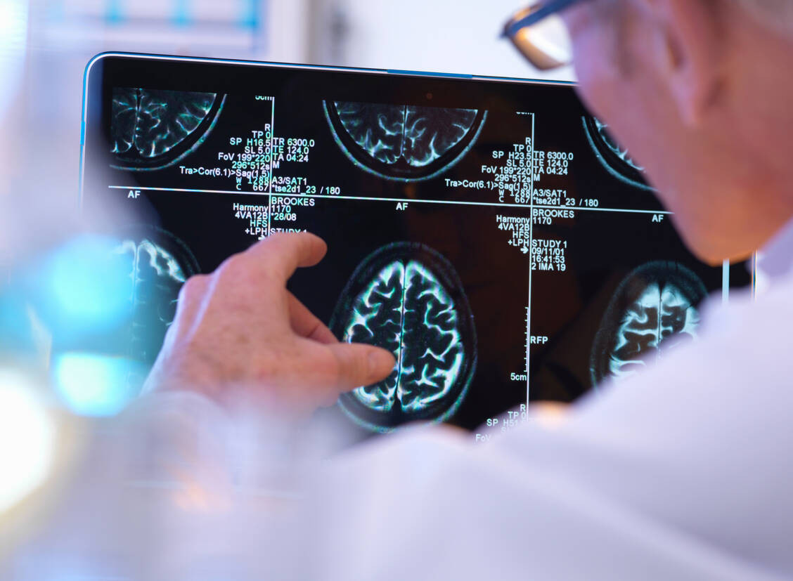 Nach dem Start einer Therapie mit MCP oder Domperidon ist das Schlaganfallrisiko erhöht. Das haben jetzt französische Forscher festgestellt. / Foto: Getty Images/Andrew Brookes