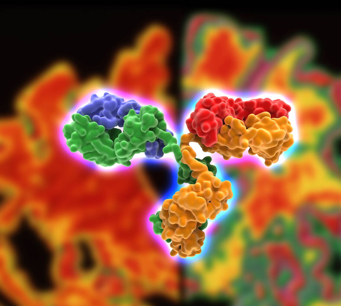 Mit Antikörpern wollen Alzheimer-Forscher schädliche Ablagerungen im Gehirn abbauen lassen. Ob sich das wirklich auf die Symptomatik auswirkt, ist immer noch nicht klinisch bewiesen. / Foto: Getty Images/Science Photo Library/Alfred Pasieka