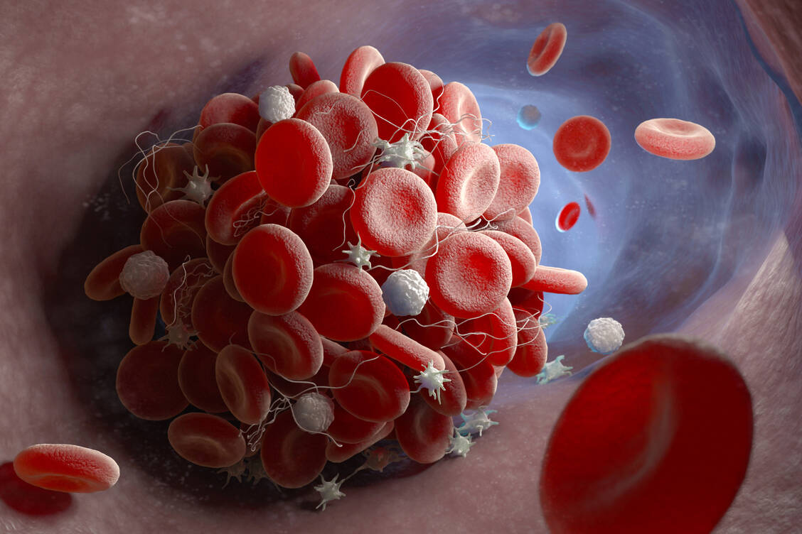 Die COX-2-Hemmer sind zwar besser magenverträglich als nicht steroidale Antiphlogistika, aber sie fördern die Thrombozytenaggregation und Gefäßentzündungen. / Foto: Stock Adobe/Tatiana Shepeleva