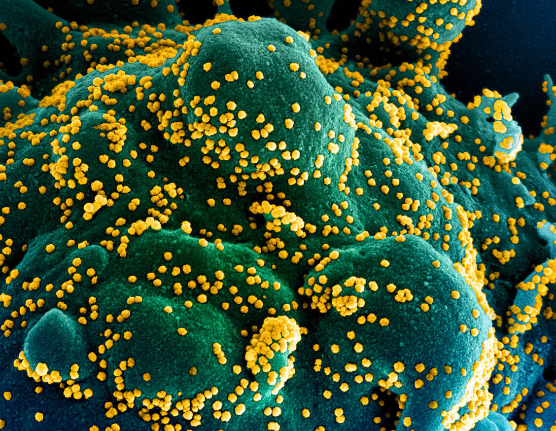 Das Coronavirus SARS-CoV-2 kann offenbar in Zellen des Darms und anderer Organe auch noch Monate nach einer akuten Infektion überdauern. / Foto: NIAID