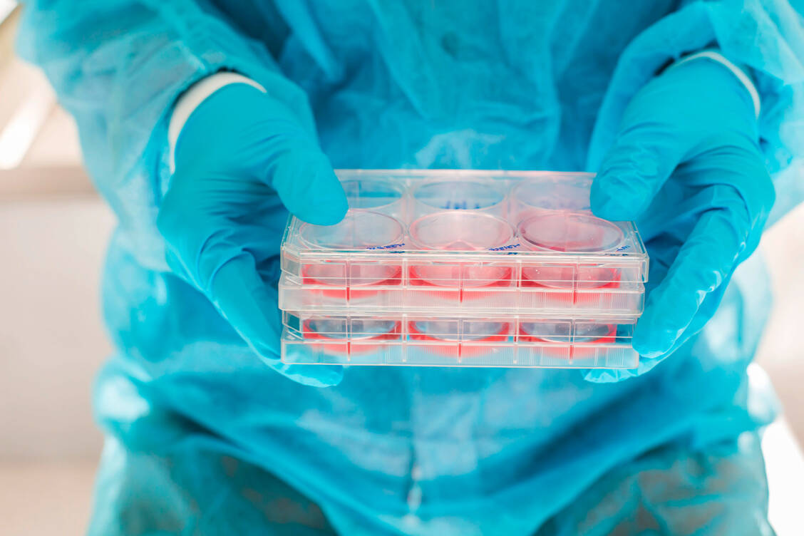 In virologischen Testsystemen wird in Frankfurt mit Hochdruck nach Substanzen gesucht, die gegen das neue SARS-Co2-Virus wirksam sein könnten. / Foto: picture alliance/Phanie
