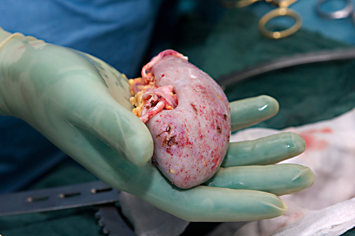 Nicht besonders groß, aber im gesunden Zustand zu Hochleistungen fähig / © Adobe Stock/horizont21