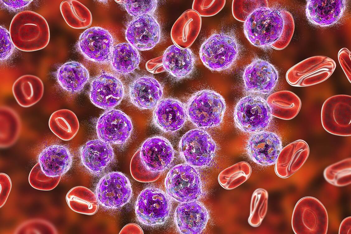 Die beiden CAR-T-Zelltherapeutika Yescarta® und Kymriah® kommen bei Patienten mit bestimmten Krebsarten zum Einsatz. / Foto: Imago/Science Photo Library
