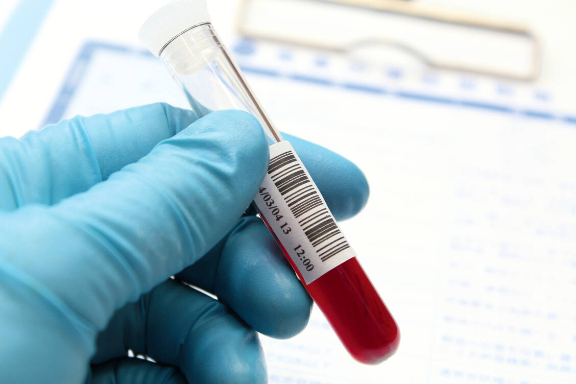 In begründeten Einzelfällen sollen Kassen künftig bei Risikoschwangerschaften die Kosten für Bluttests  übernehmen. / Foto: Fotolia/Picasa