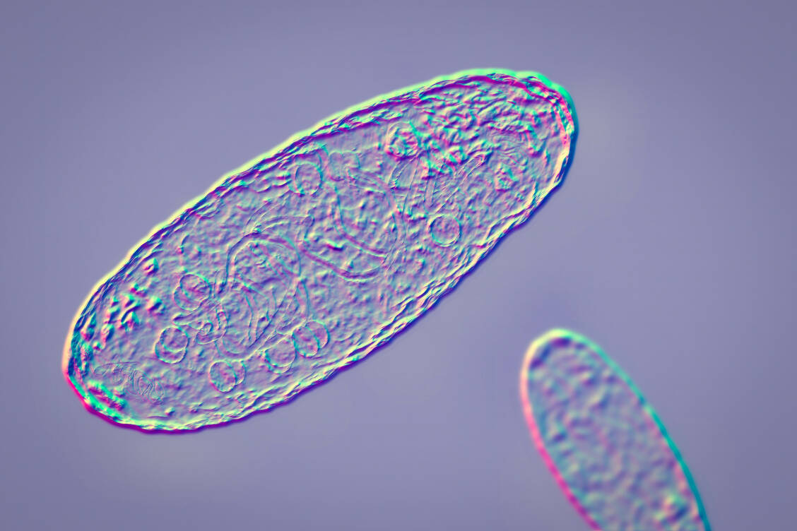 Nicht erst im Mittelalter entwickelten Stämme des Pesterregers ihre tödliche Wirkung. Schon Steinzeitmenschen fielen ihnen zum Opfer.  / © Getty Images/Kateryna Kon/Science Photo Library