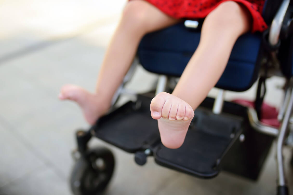 Bei Kindern mit Zerebralparese kann es zu Verkrampfungen der Zehen kommen. Solche Spastiken können extrem schmerzhaft sein. / © Shutterstock/Maria Sbytova