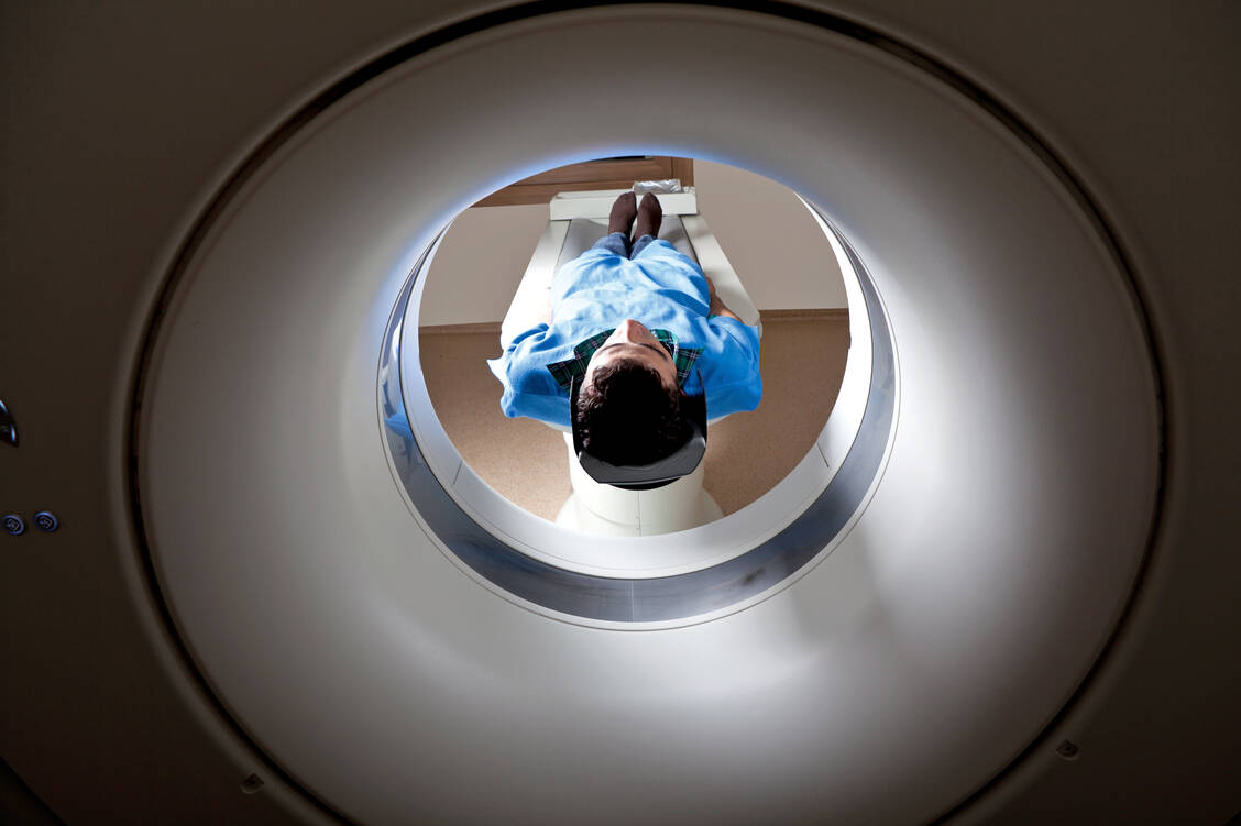 Das Glioblastom ist ein äußerst schwierig zu therapierender Hirntumor. Möglicherweise können ZNS-gängige Antihistaminika bei dieser Erkrankung vorteilhaft sein. / Foto: iStockphoto/selimaksan