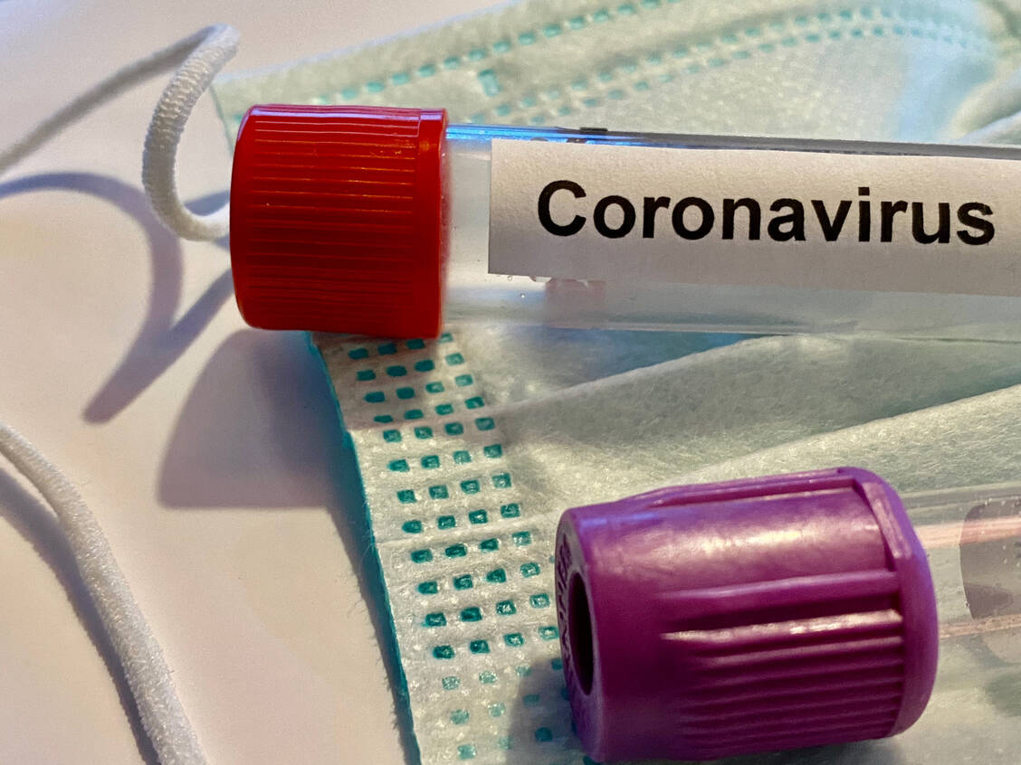 Das RKI schätzt die Dunkelziffer der SARS-CoV-2-Infizierten derzeit als gering an. Das belegen Stichproben aus den Sentinel-Praxen. / Foto: Getty Images/PS3000