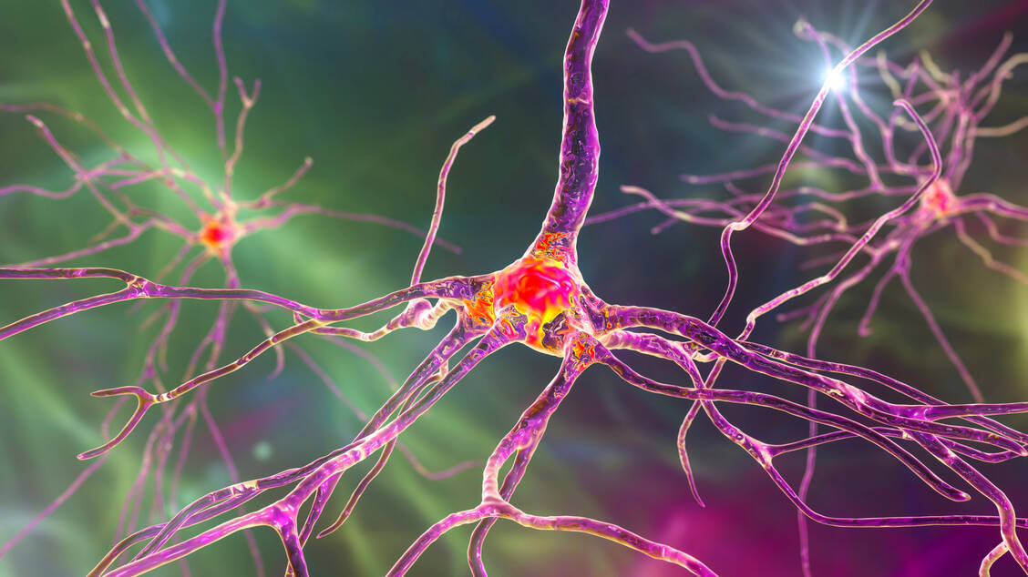 Bei Patienten mit Diabetes ist die Regenerationsfähigkeit von Neuronen eingeschränkt. Einen zentralen Mechanismus dahinter hat ein Kölner Forschungsteam an Tiermodellen entdeckt.  / © Getty Images/Kateryna Kon/Science Photo Library
