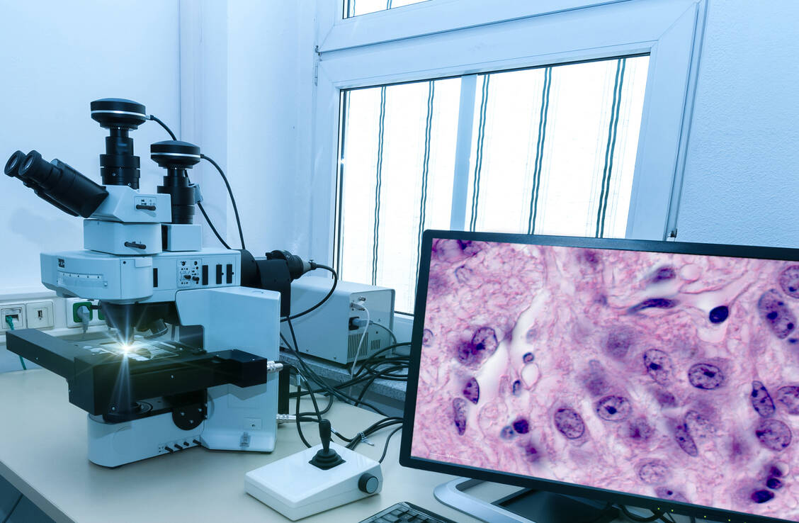 Die Diagnose des Mantelzell-Lymphoms erfolgt histopathologisch anhand eines befallenen Lymphknotens. / Foto: Getty Images/anyaivanova (Symbolbild)
