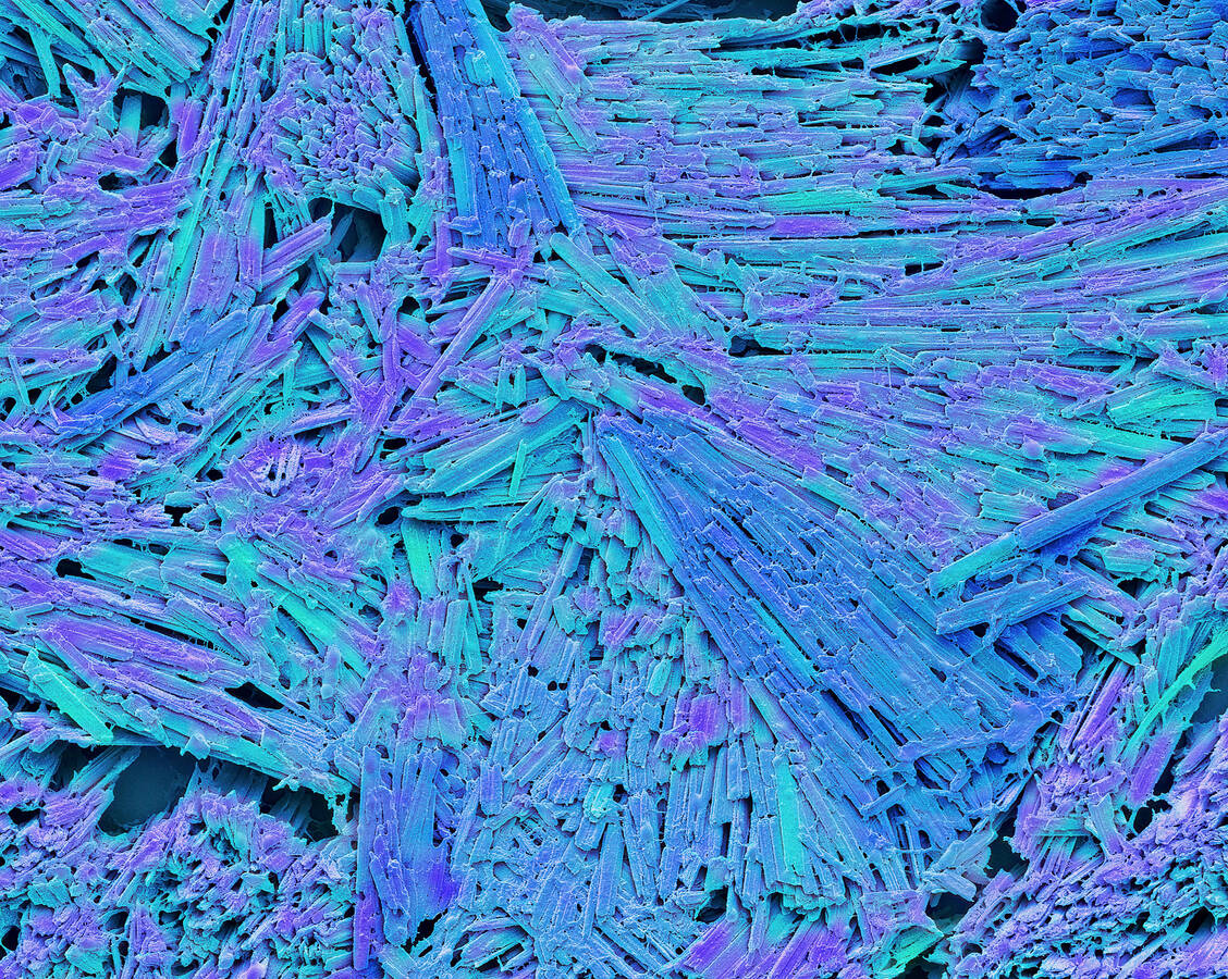 Bei Gicht ist der Harnsäurespiegel erhöht. Wird das Löslichkeitsprodukt überschritten, bilden sich Kristalle in Gelenken. Das ist sehr schmerzhaft. / Foto: Getty Images/Steve Gschmeissner/Science Photo Library