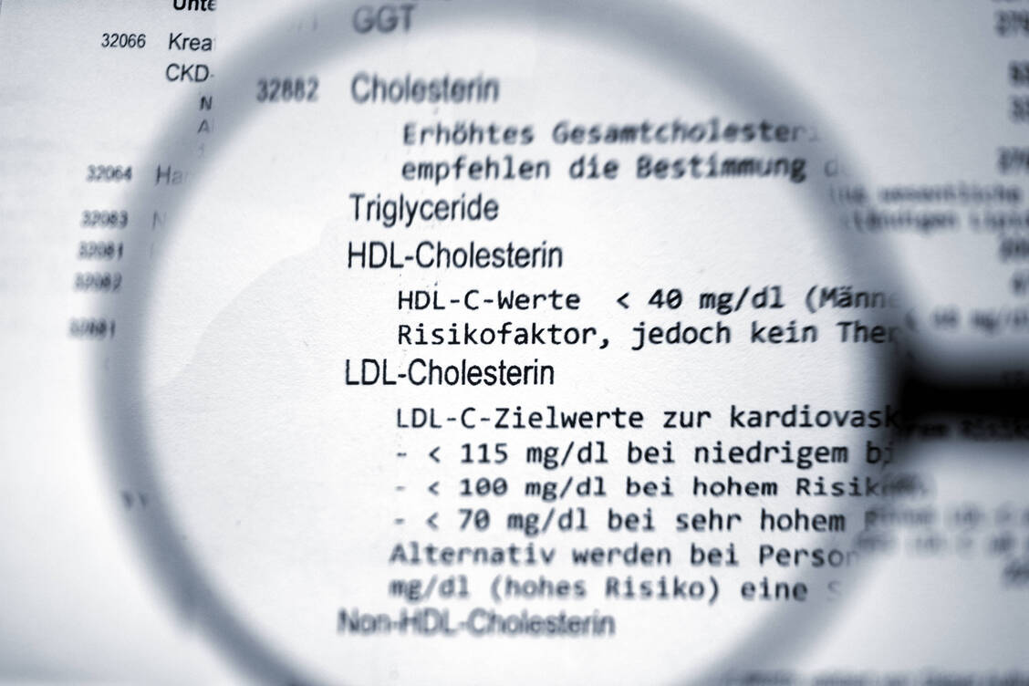 Zielwerte für das LDL-Cholesterol, wie sie in Europa gebräuchlich sind, gibt es in den USA seit einiger Zeit nicht mehr. / Foto: Imago/Zoonar