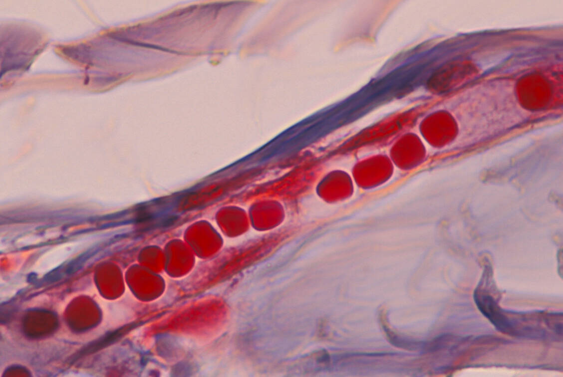 Beim Kapillarlecksyndrom werden die Wände der Kapillaren durchlässig. Plasma und Proteine gehen in die Zwischenräume über, was wiederum dort zu starken Wassereinlagerungen führt, während das Blut eindickt und der Blutdruck fällt. / Foto: Getty Images/Ed Reschke