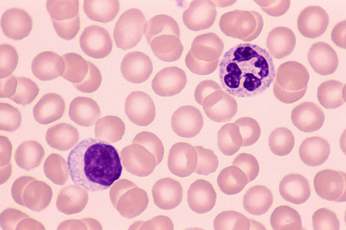 Menschen mit WHIM-Syndrom weisen charakteristischerweise niedrige Blutwerte an Neutrophilen und Lymphozyten auf.  / © Getty Images/Ed Reschke