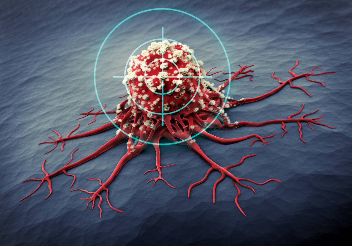 Krebstherapeutika müssen nicht immer den Tumor im Visier haben. Sie können auch das Immusystem mobilisieren, das dann den Tumor attackiert. / Foto: Fotolia/psdesign1