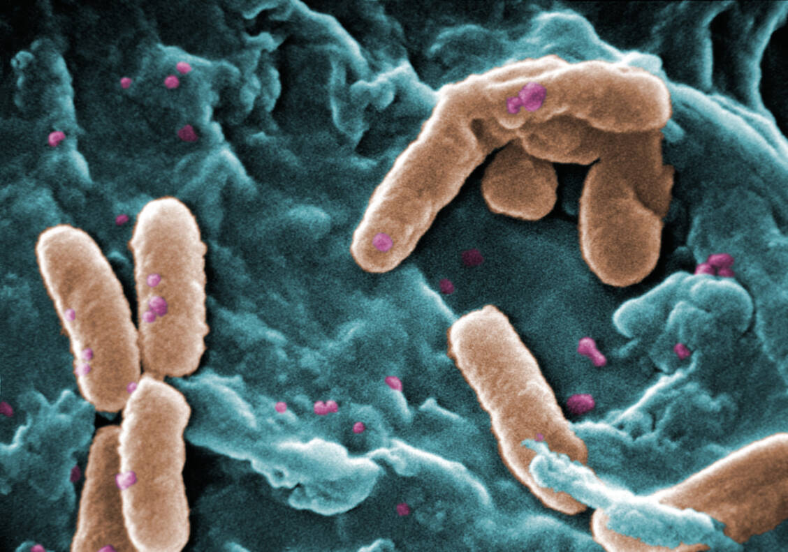 Das gramnegative Bakterium Pseudomonas aeruginosa vereint häufig mehrere Resistenzmechanismen; daher ist es besonders schwer antibiotisch zu behandeln. / © CDC/Janice Haney Carr