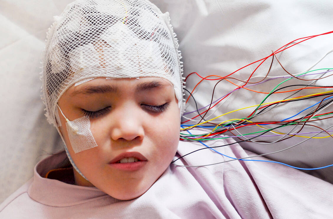 Kinder mit CDKL5-Mangelerkrankung leiden unter häufigen schweren epileptischen Anfällen, die auf verfügbare Antiepileptika  kaum ansprechen. Ganaxolon deckt somit einen hohen medizinischen Bedarf. / © Shutterstock/vasara