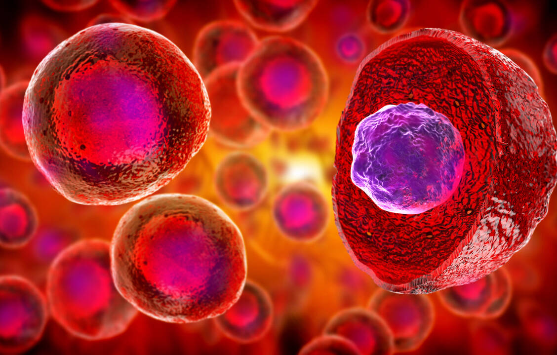 Nach einem Schlaganfall werden große Mengen des Entzündungsbotenstoffs IL-1β freigesetzt. Dieser fördert Entzündungen und Folgeerkrankungen. / Foto: Adobe Stock/Giovanni Cancemi