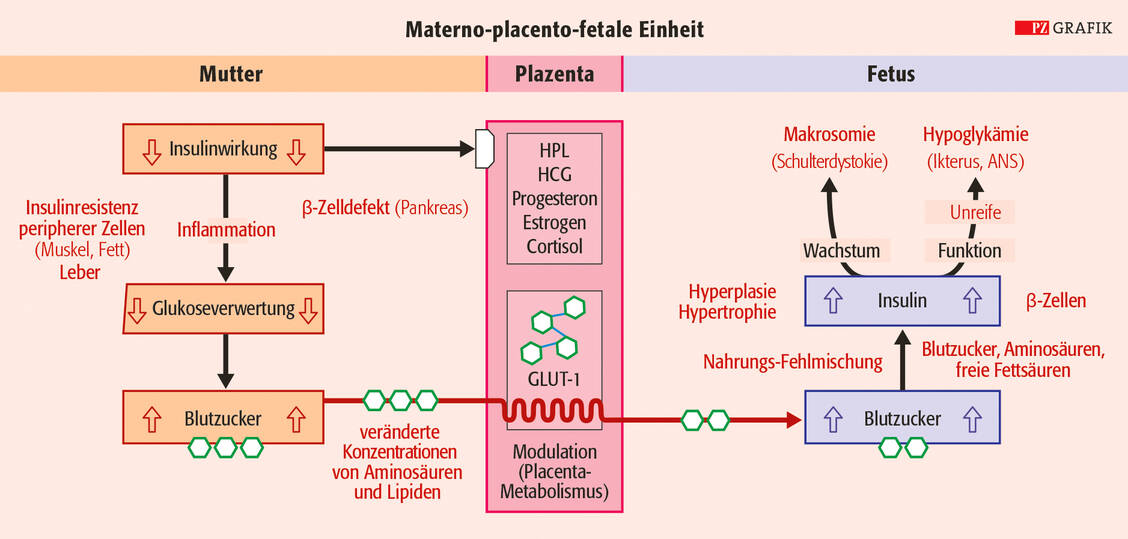Grafik 2: Die mütterliche Hyperglykämie führt via plazentaren Glukosetransport vorwiegend über Glukosetransporter (GLUT-1) zur fetalen Hyperglykämie mit morphologischen und funktionellen Folgen für das Kind (nach Pedersen, Kopenhagen, und Freinkel, Chicago). HPL = Humanes Placentalactogen, HCG = Humanes Choriongonadotropin, ANS = Atemnotsyndrom / Foto: Stephan Spitzer
