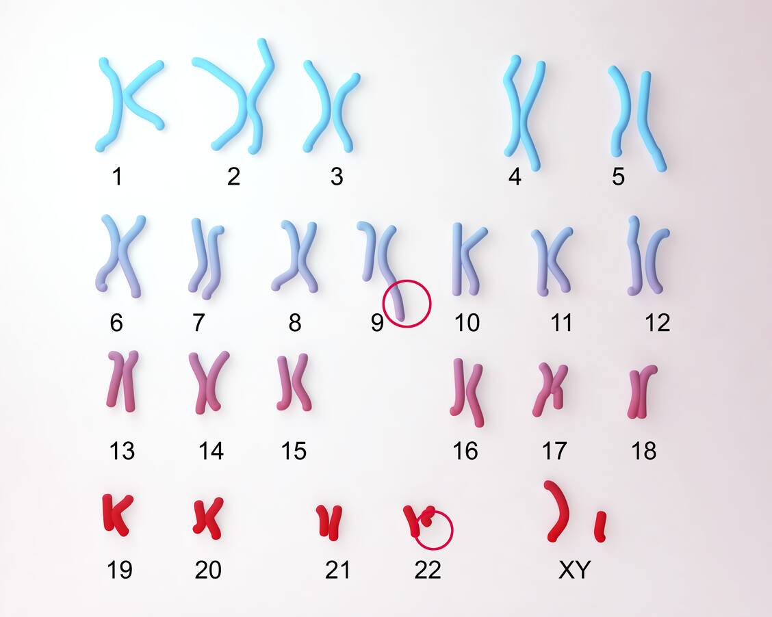 Das Philadelphia-Chromosom, das aus einer Fusion der Chromosomen 9 und 22 entsteht, ist charakteristisch für die chronische myeloische Leukämie. / Foto: Getty Images/Kateryna Kon