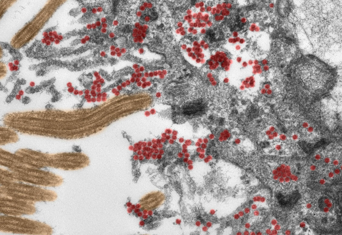 Elektronenmikroskopische Aufnahme einer Zelle in der Riechschleimhaut mit SARS-CoV-2 (rot). / Foto: Michael Laue/RKI & Carsten Dittmayer/Charité