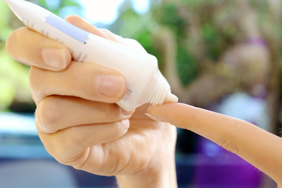 Für dermale Glucocorticoide der Klassen 1 und 2 eignet sich als Dosierungshilfe bei einem Tubenöffnungsdurchmesser von 5 mm die Fingerspitzenmethode. / Foto: Adobe Stock/Dan Race