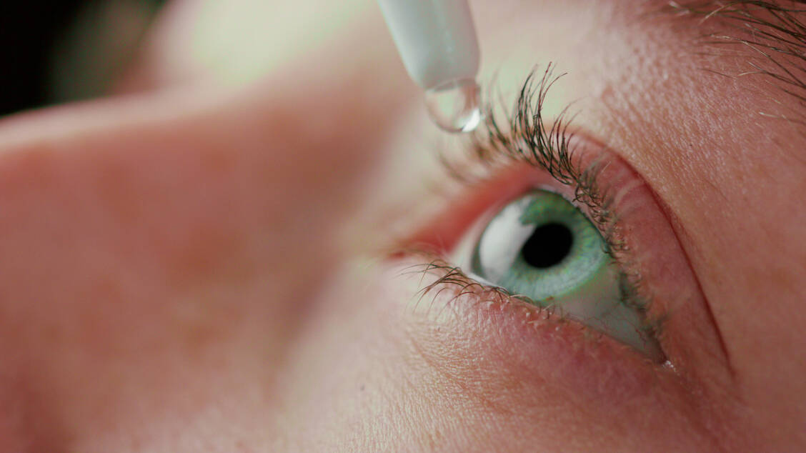 Viele Krebspatienten leiden am Trockenen Auge. Befeuchtende Augentropfen können unterstützend wirken. / © Adobe Stock/mputsylo