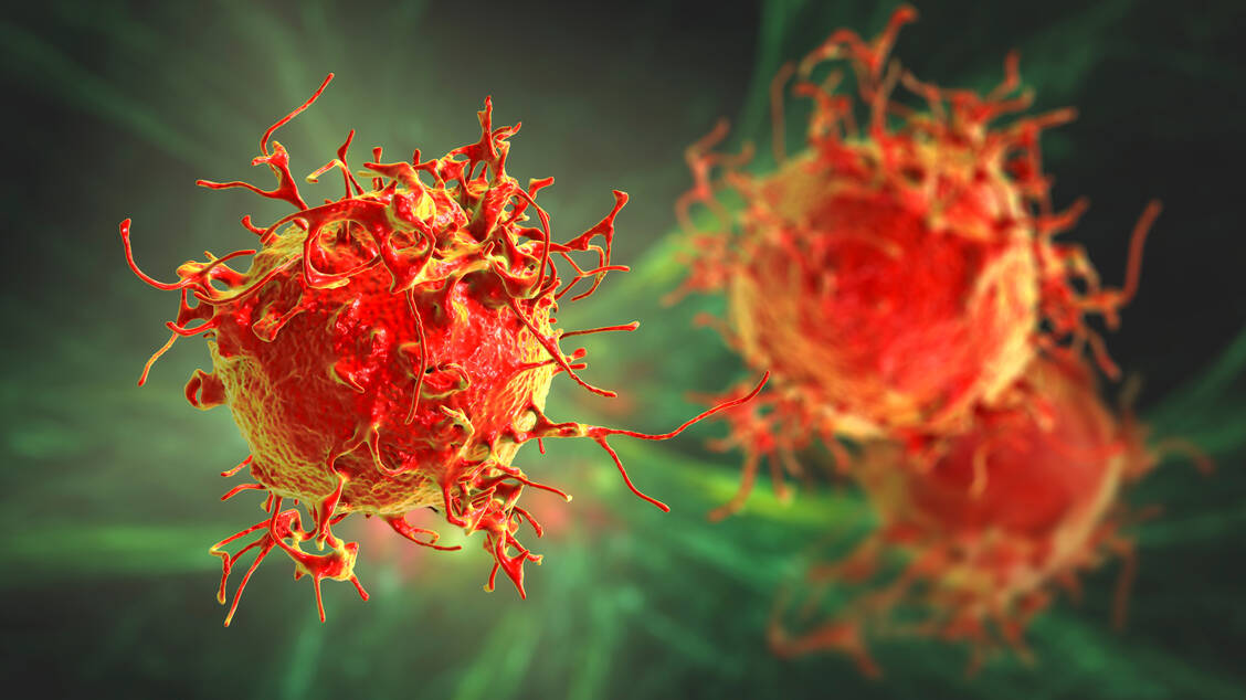 Das Multiple Myelom ist eine Form von Knochenmarkkrebs, bei der die Krebszellen bestimmte Oberflächenproteine exprimieren – hier greift die CAR-T-Zelltherapie an. / Foto: Getty Images/Dr_Microbe