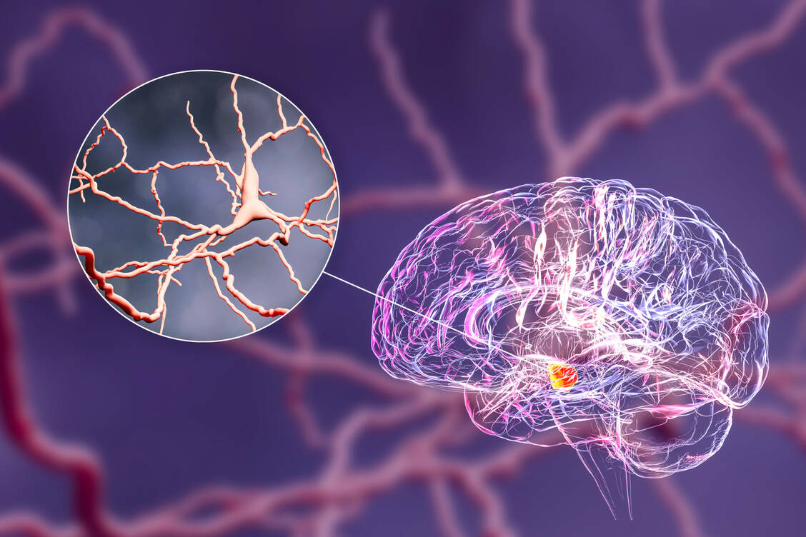 Bei Parkinson sterben die Nervenzellen in der Substantia nigra. Kurz davor werden  Gene aus dem Biotin-Stoffwechsel vermehrt exprimiert. / © Getty Images/Science Photo Library/Kateryna Kon