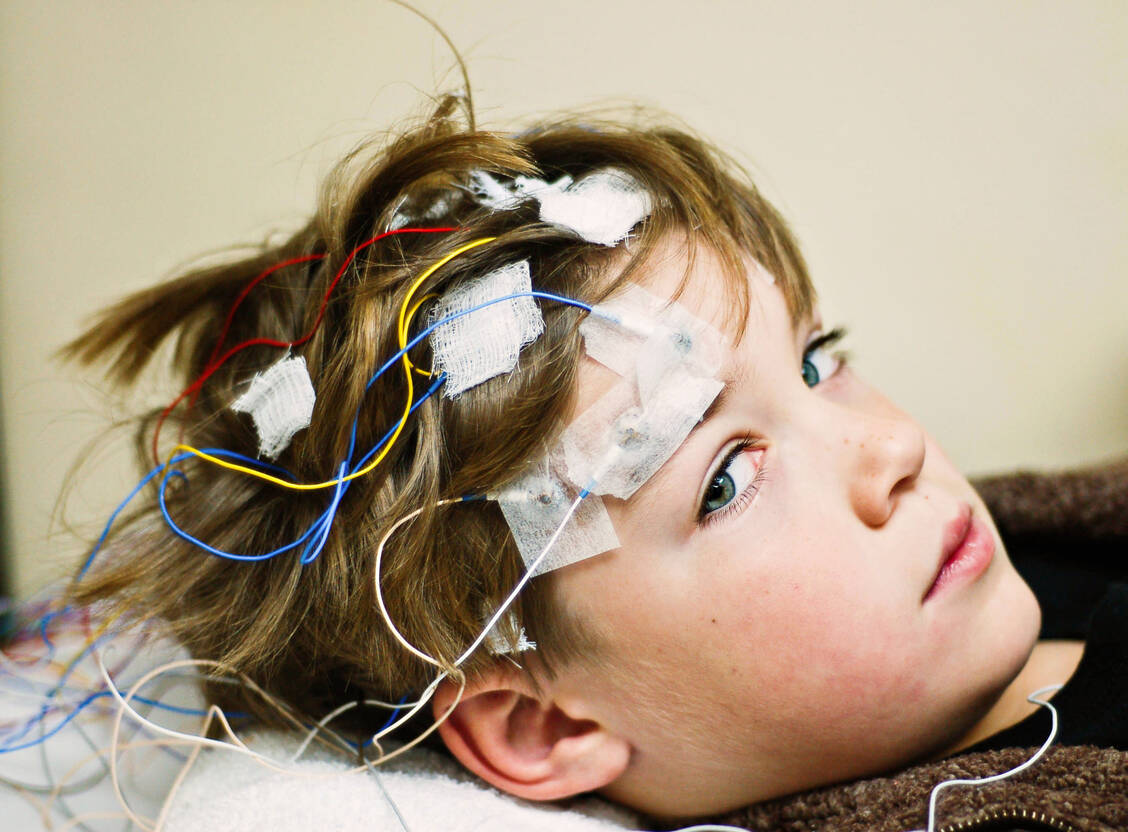 Das Dravet-Syndrom ist eine schwere und oft therapieresistente Form der kindlichen Epilepsie.  / Foto: Getty Images/Sallywatts