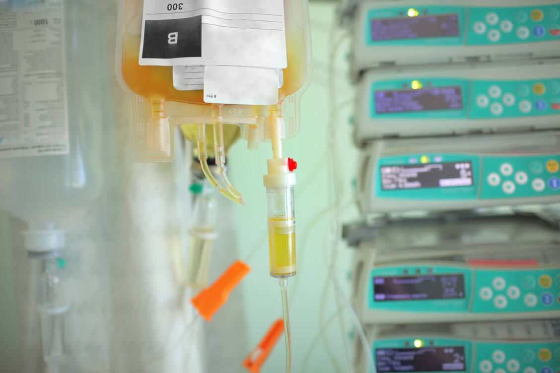 Transfusionen mit sogenanntem Rekonvaleszenten-Plasma scheinen nicht die Sterblichkeit von Covid-19-Patienten zu senken, so die aktuelle Studienlage. / Foto: Adobe Stock/sudok1