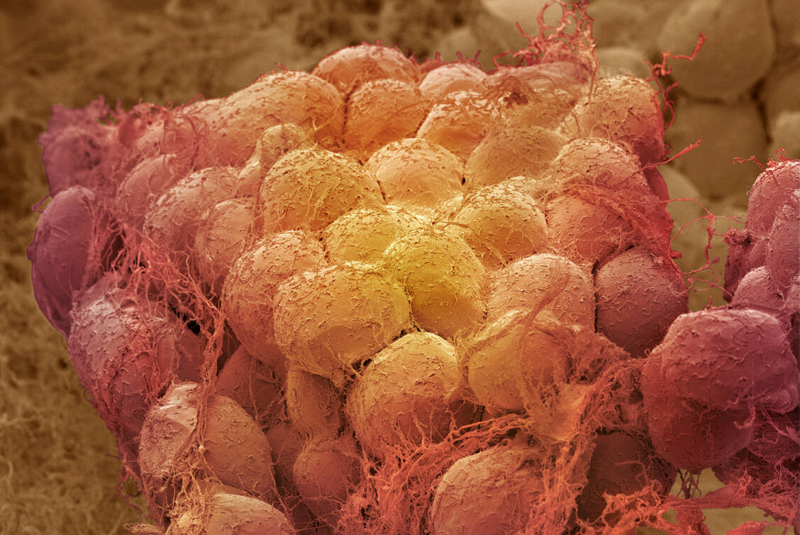 Fettzellen produzieren das Protein FABP4, das zusammen mit zwei Enzymen das Hormon Fabkin bildet. / Foto: Getty Images/Steve Gschmeissner/Science Photo Library