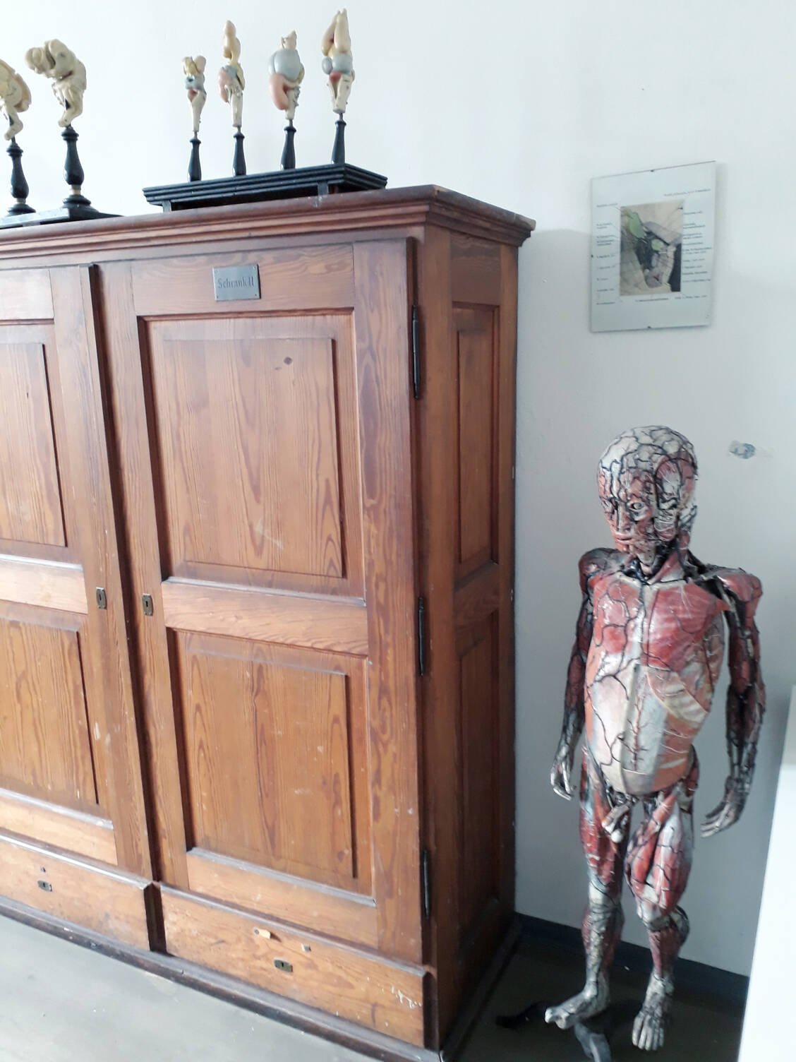 Pappmaché-Modell aus der Werkstatt von Louis Thomas Jérôme Auzoux, 1847 (Anatomische Sammlung der Universität Marburg) / Foto: Rainer Brömer