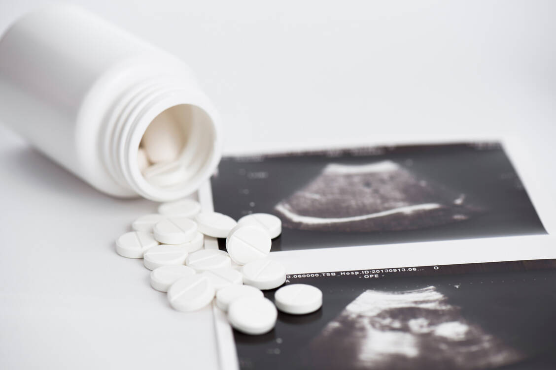 Den Ergebnissen einer neuen Studie zufolge führt die alleinige Anwendung von Misoprostol zu ebenso effektiven und sicheren Schwangerschaftsabbrüchen wie die bislang übliche Kombination mit Mifepriston.   / Foto: Adobe Stock/ivanko80