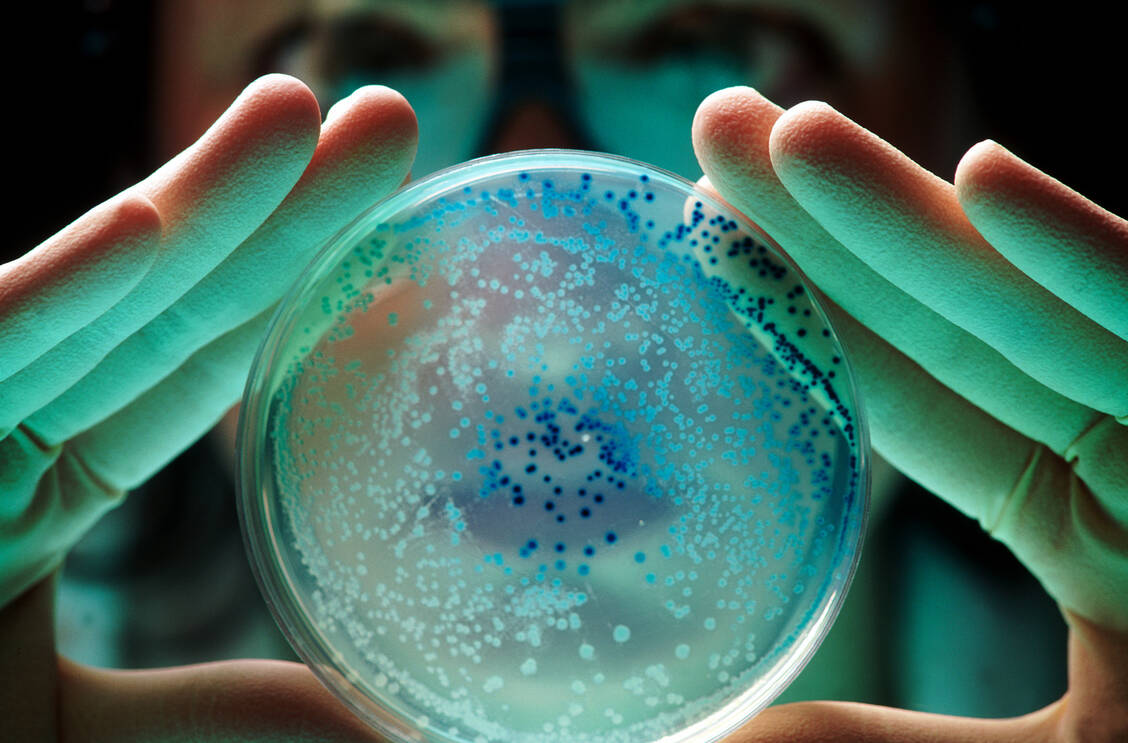 Antibiotikaresistenzen werden zunehmend zum Problem. Zu diesem Ergebnis kommt eine globale Analyse. / Foto: Getty Images/Ted Horowitz Photography