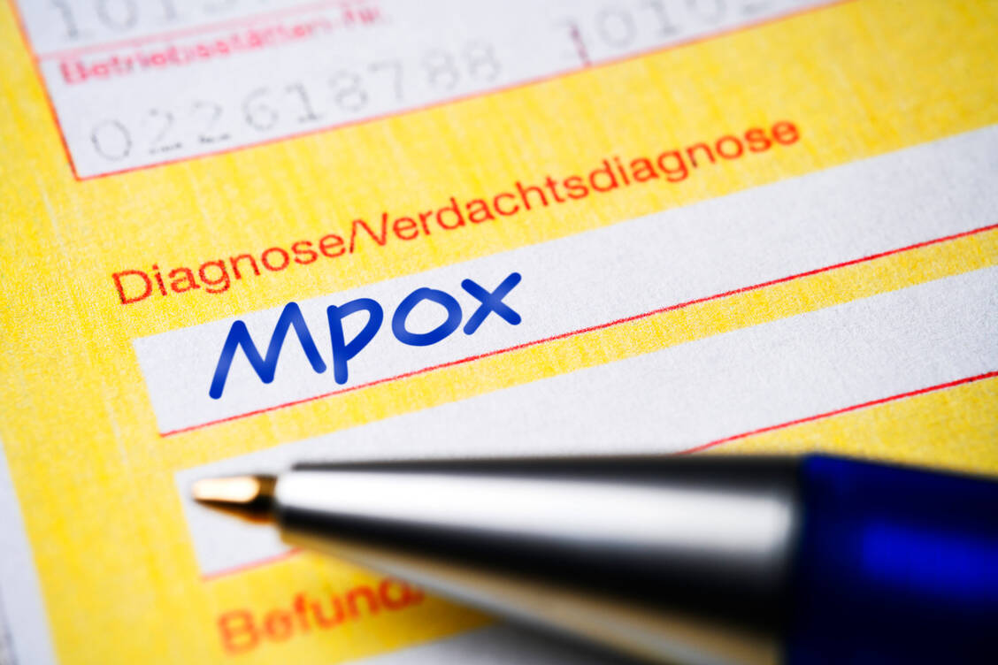 Tecovirimat ist nicht mehr bei Mpox zugelassen. Damit gibt es aktuell keinen Wirkstoff für diese Indikation. / © Imago Images/Christian Ohde