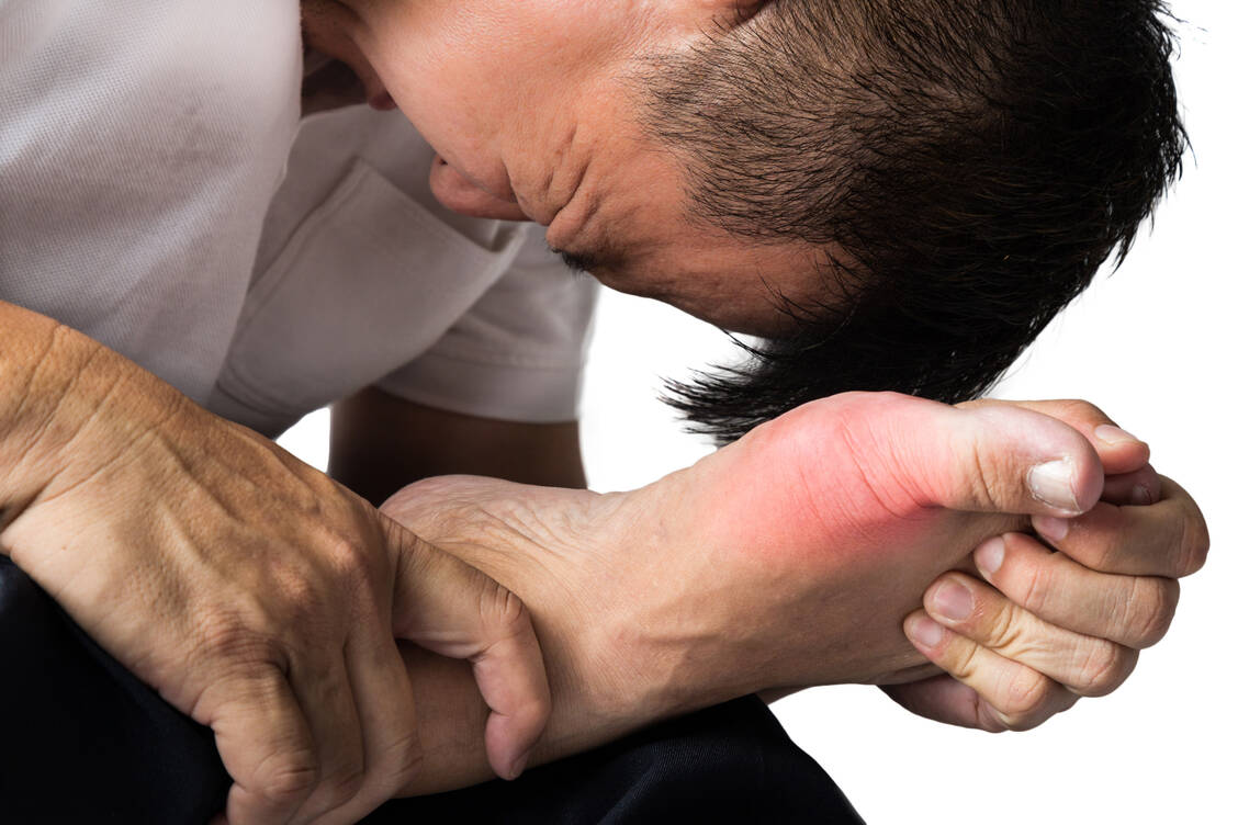 Der akute Gichtanfall ist extrem schmerzhaft. / Foto: Adobe Stock/ThamKC