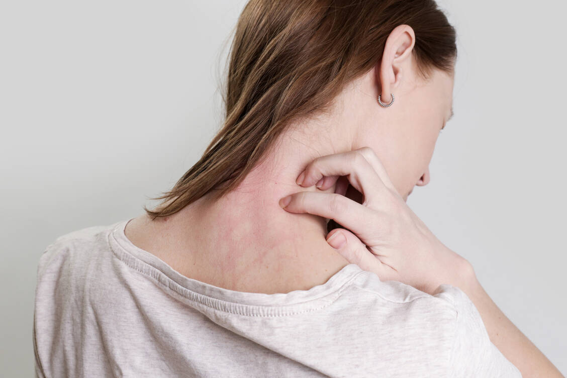 Symptome von Arzneimittelallergien können von einem harmlosen Jucken bis hin zu schwerwiegenden Syndromen reichen. / Foto: Getty Images/triocean